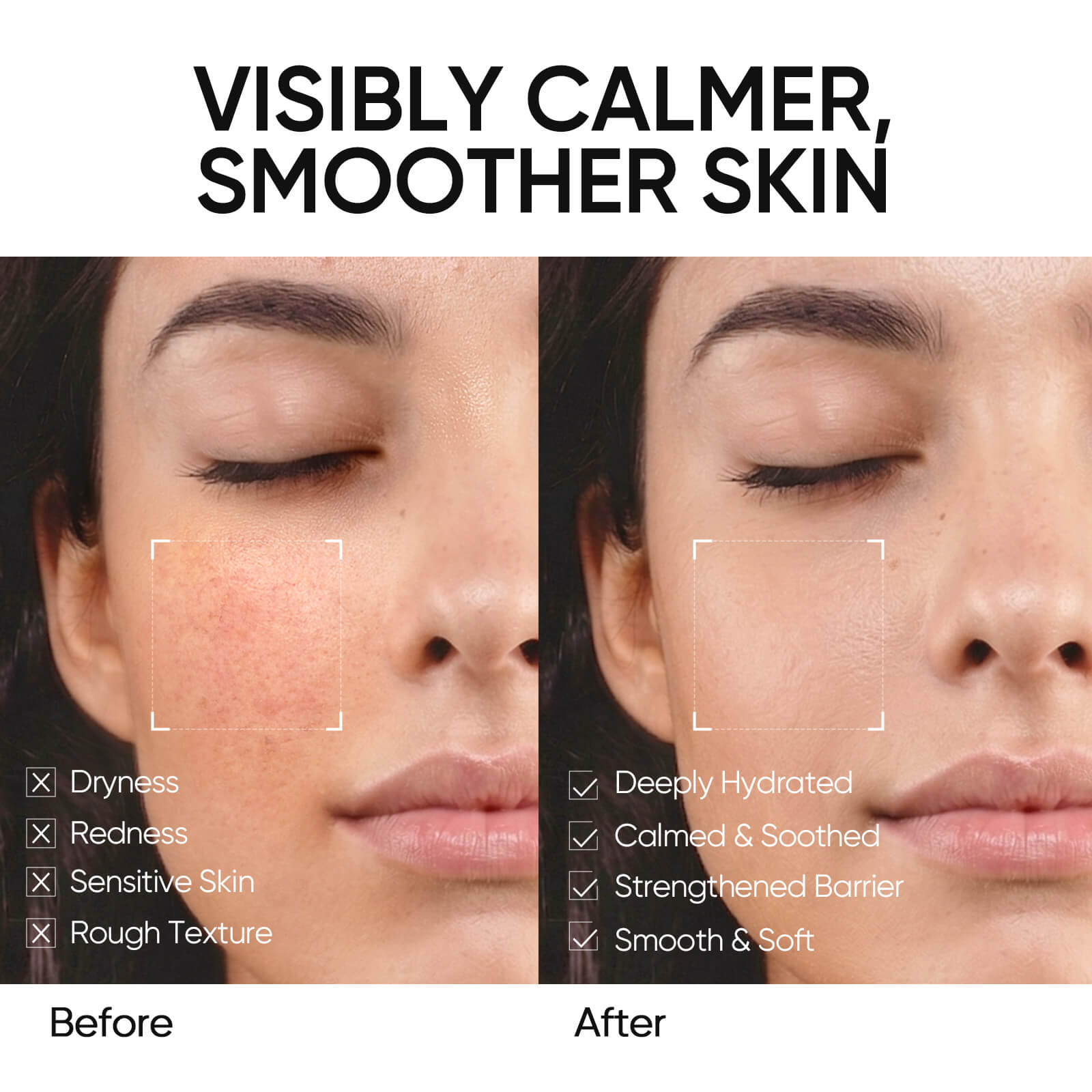 5X Ceramide Barrier Repair Moisture Gel