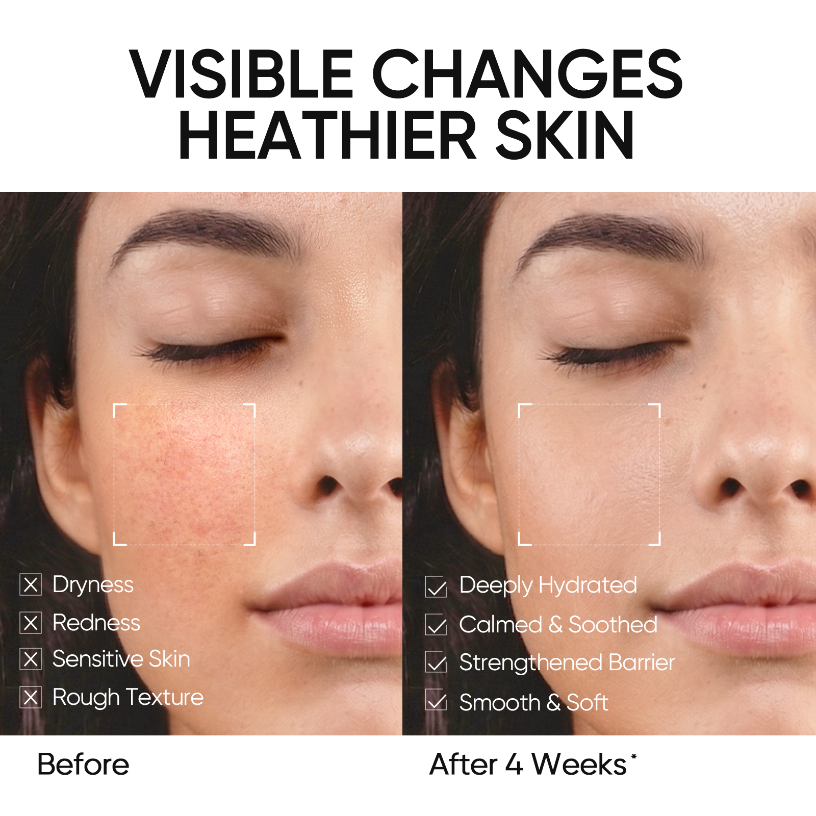 Gel Hidratante Reparador de la Barrera con 5X Ceramidas