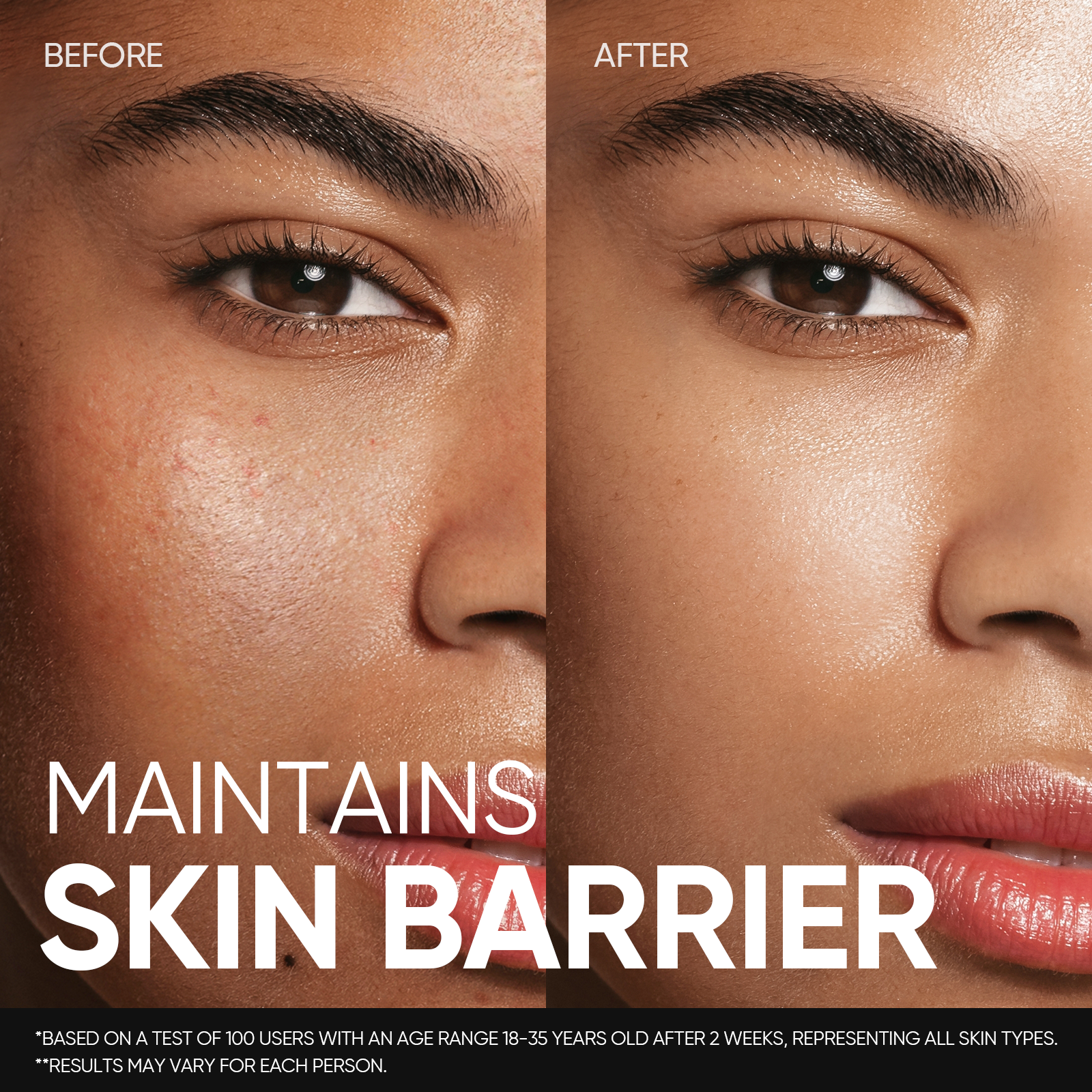 5X Ceramide Soothing Skin Barrier Toner