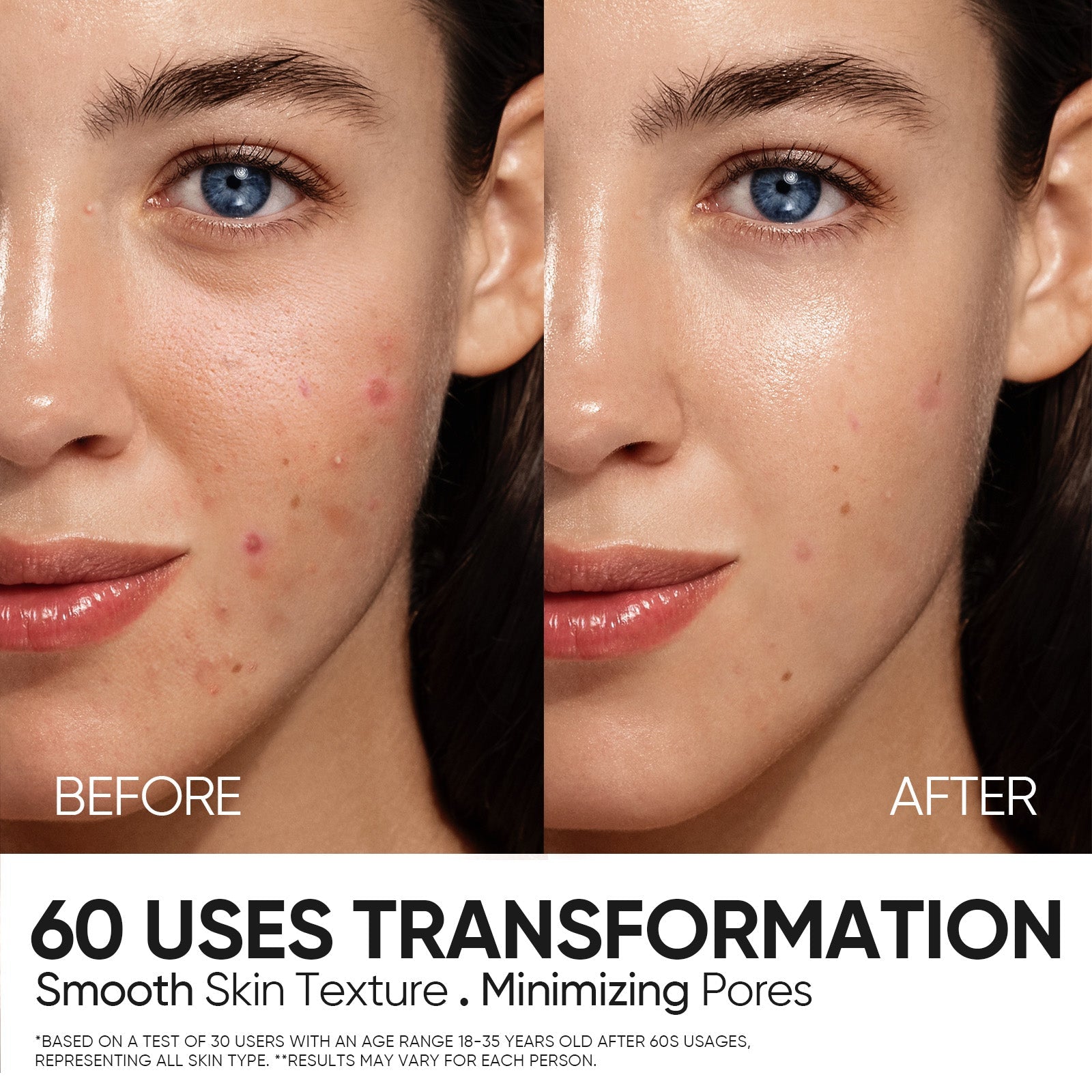 12% AHA BHA PHA LHA Peeling Solution Serum
