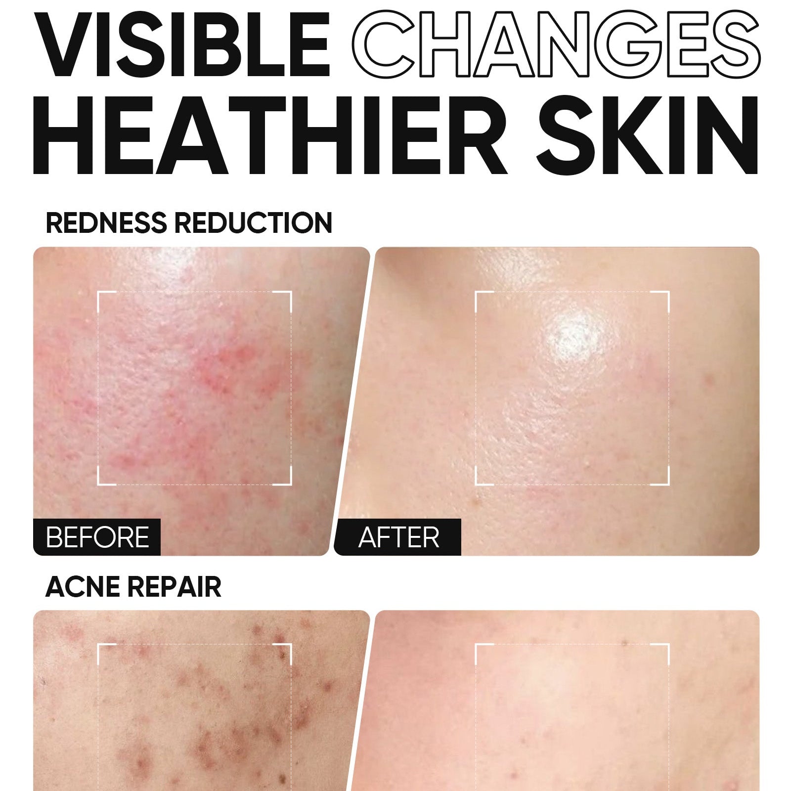 5X Ceramide Barrier Repair Moisture Gel