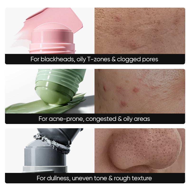 #Option_Blackhead Control + Acne Care + Brightening