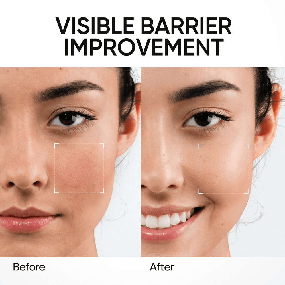 5X Ceramide Barrier Repair Moisture Gel