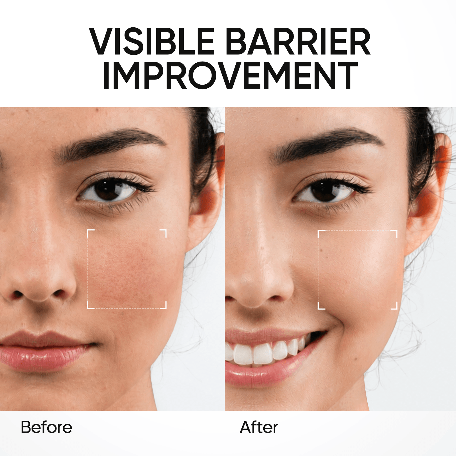 5X Ceramide Barrier Repair Moisture Gel