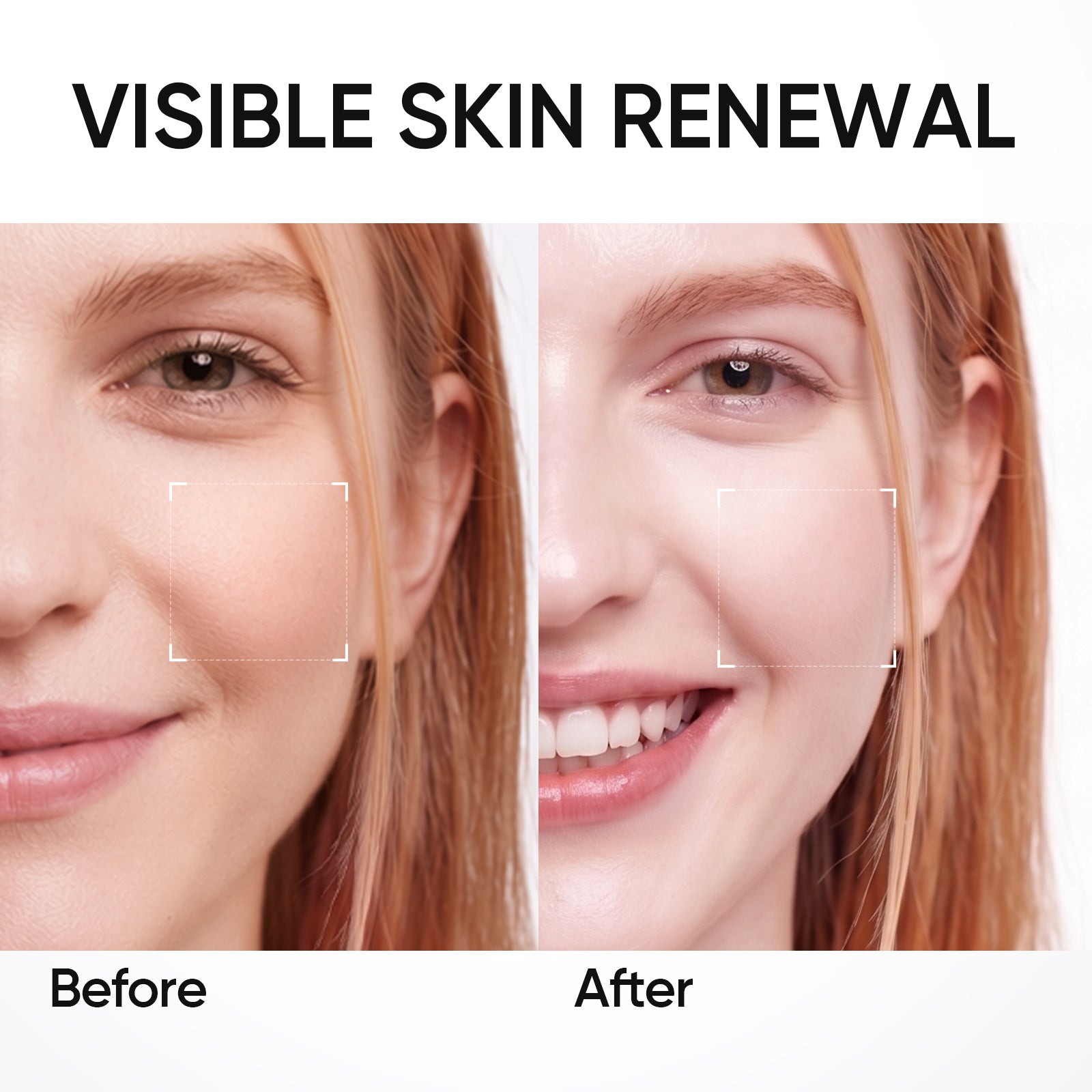 PDRN Brightening Smooth Serum