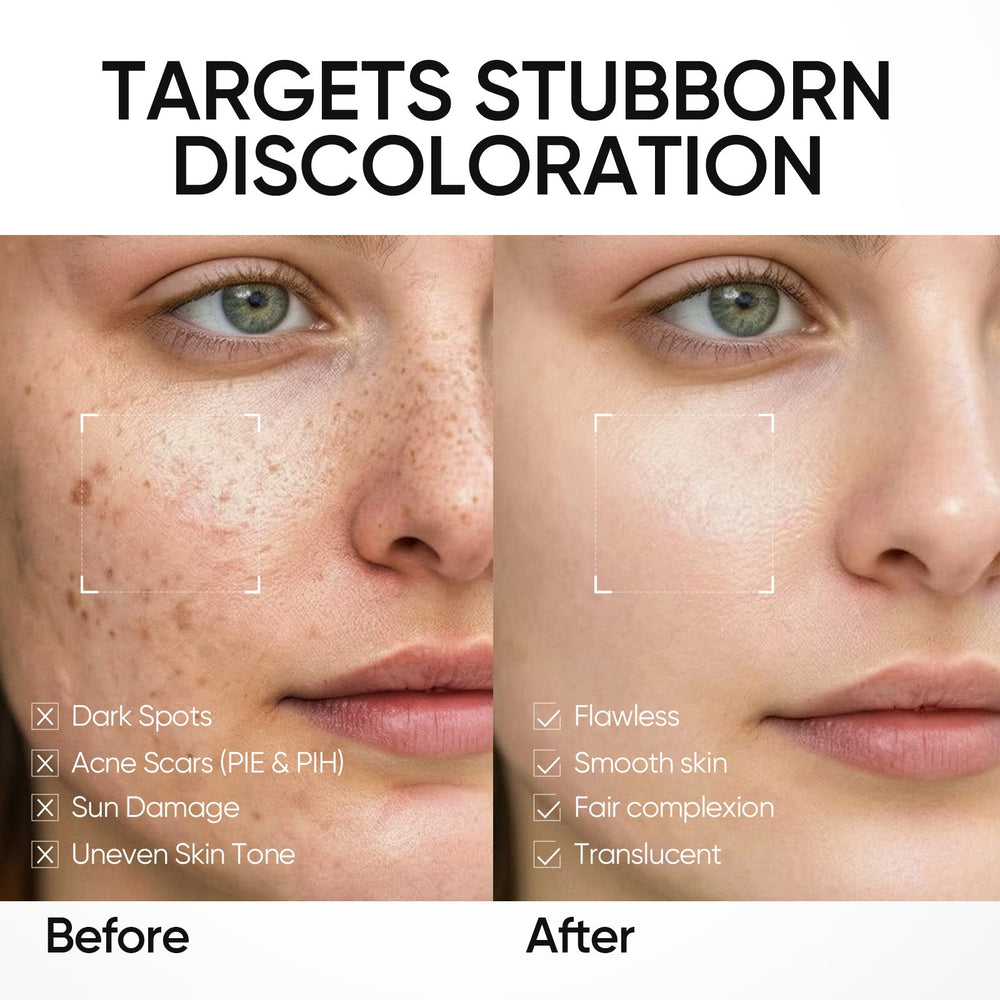 377 Dark Spot Brightening Routine Set