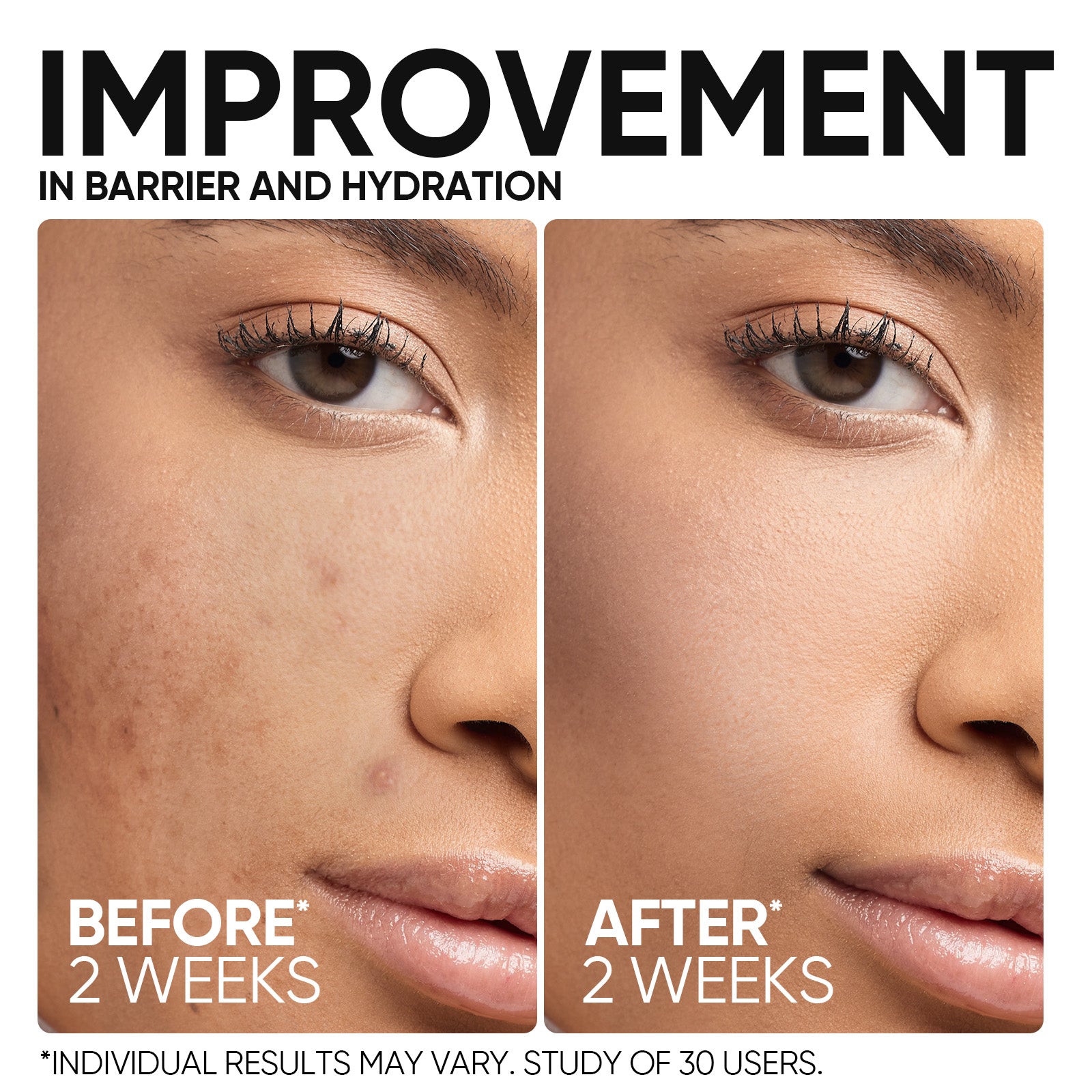 5X Ceramide Skin Barrier Repair Serum