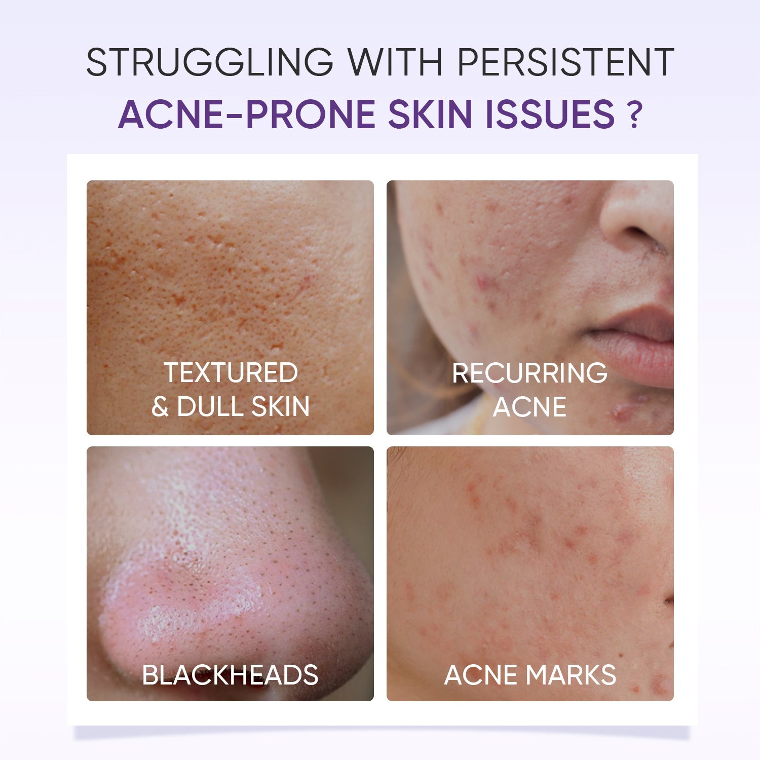 Lactic Acid Exfoliating Serum Smooth & Bright Skin