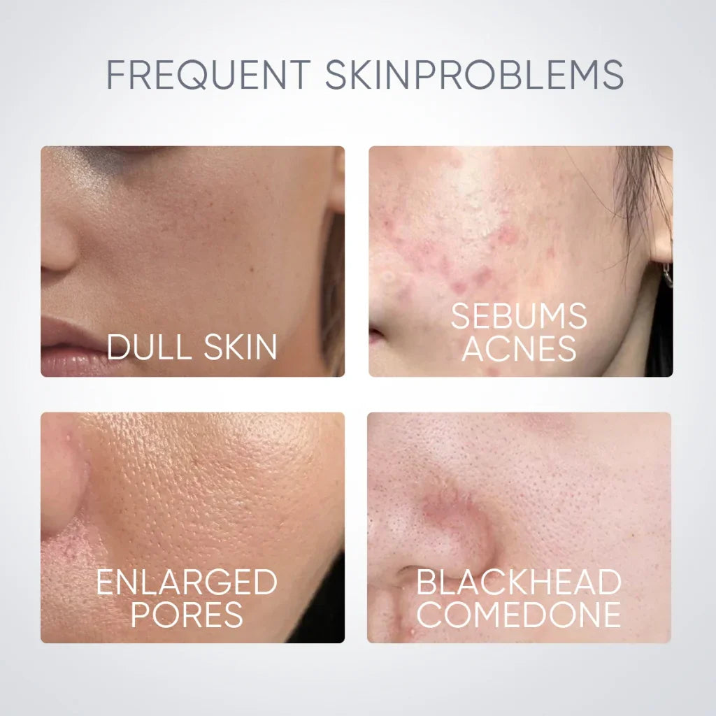 Alaska Volcano Blackhead & Pore Deep Cleansing Clay Mask Stick